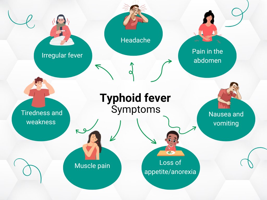 Illustration showing various symptoms of typhoid fever including headache, pain in the abdomen, nausea and vomiting, loss of appetite, muscle pain, tiredness and weakness, and irregular fever.